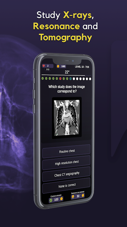 #2. RX Trivia - Radiology Quiz (Android) By: Tarter Studio